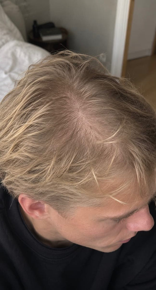 Före